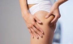 Ritenzione idrica Varese Vergiate