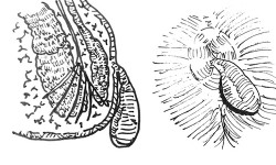 Condilomi anali Dr. Tessera