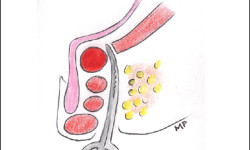 Fistole Anali Varese Vergiate – Dott. Tessera