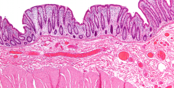 Prolasso del retto – Dr. Tessera