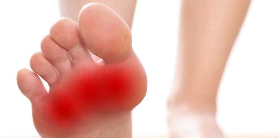 Metatarsalgia Vergiate Varese