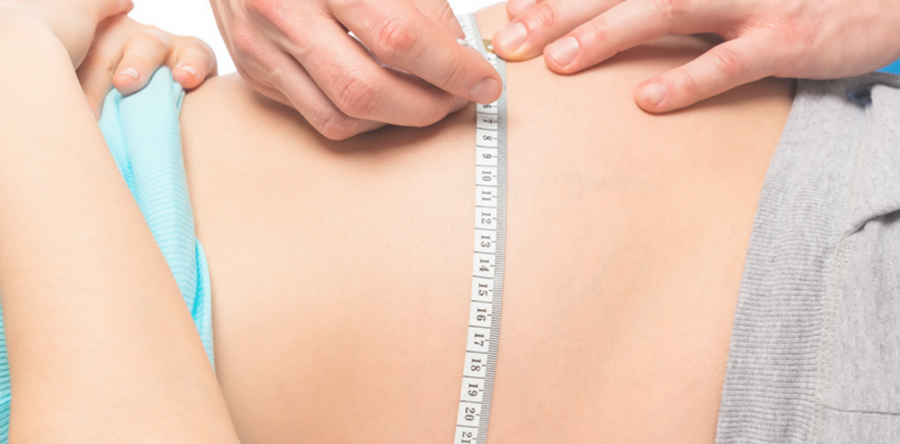 Cura dell’Obesità Vergiate Varese