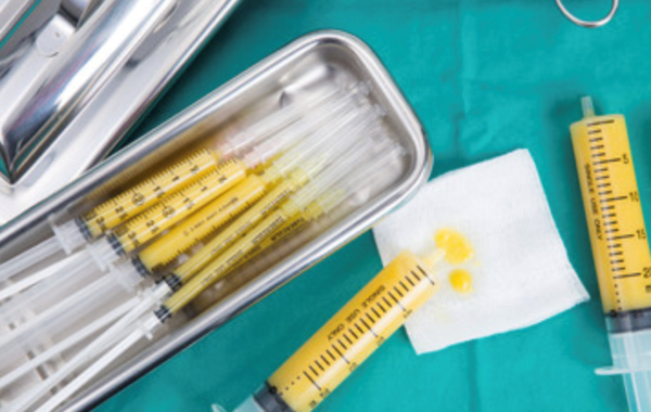 Lipofilling mediante l’utilizzo del proprio tessuto adiposo