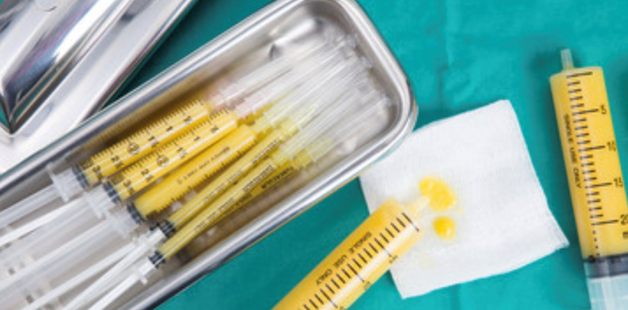 Lipofilling mediante l’utilizzo del proprio tessuto adiposo