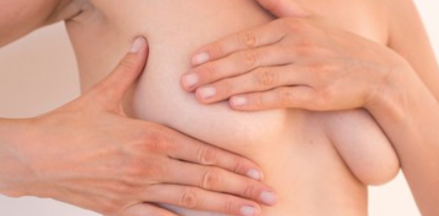 Mastopessi: sollevare e dare forma al seno cadente