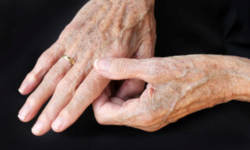 Ringiovanimento delle mani: i rimedi per mani più giovani