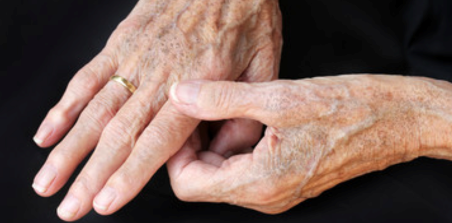 Ringiovanimento delle mani: i rimedi per mani più giovani