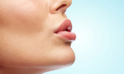 Filler labbra con ialuronico: rifarsi le labbra ma senza esagerare