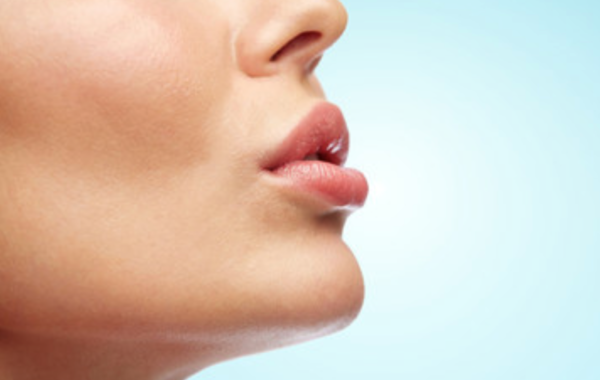 Filler labbra con ialuronico: rifarsi le labbra ma senza esagerare