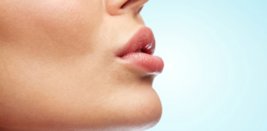 Filler labbra con ialuronico: rifarsi le labbra ma senza esagerare